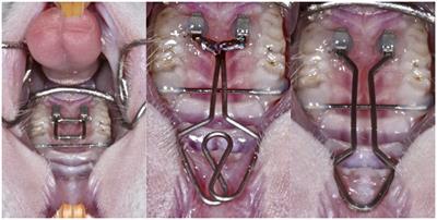 Impact of Orthodontic Forces on Plasma Levels of Markers of Bone Turnover and Inflammation in a Rat Model of Buccal Expansion